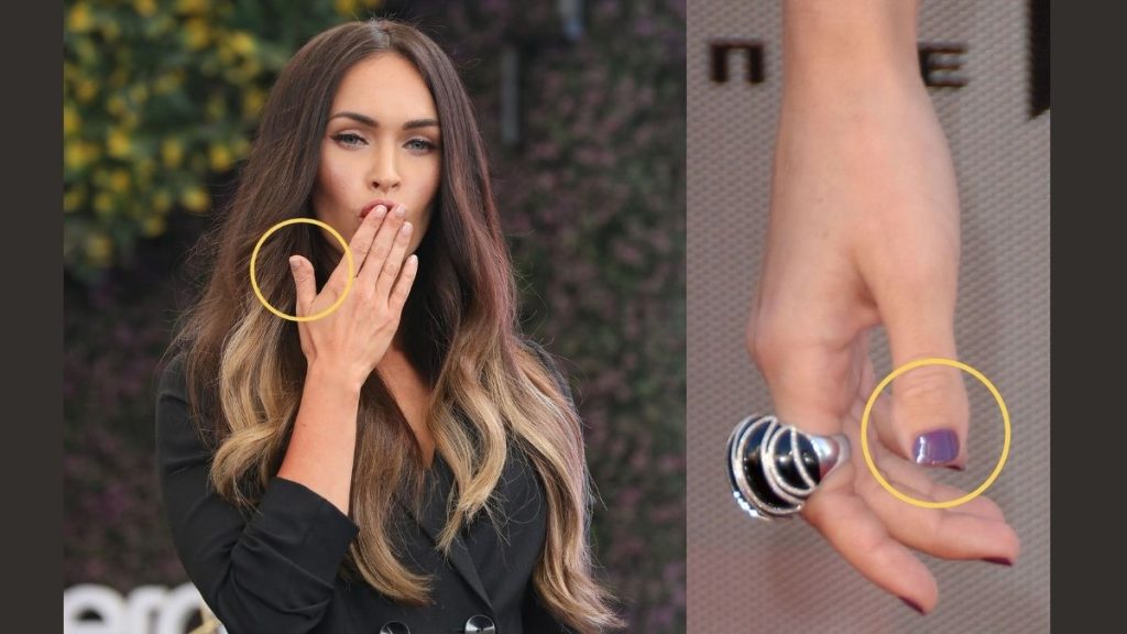 Megan Fox Thumbs What Happened To It Find Out Dicy Trends